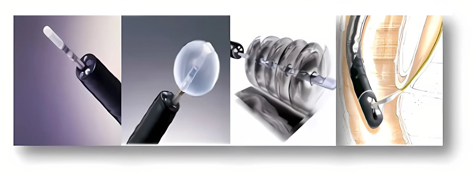 Small Probe Endoscopic Ultrasound Small Probe Endoscopic Ultrasound