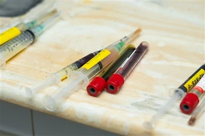コスト、安​​全性、標準化 - ART 研究所の再建におけるワンタイム OPU 針の経済性と品質管理システム-